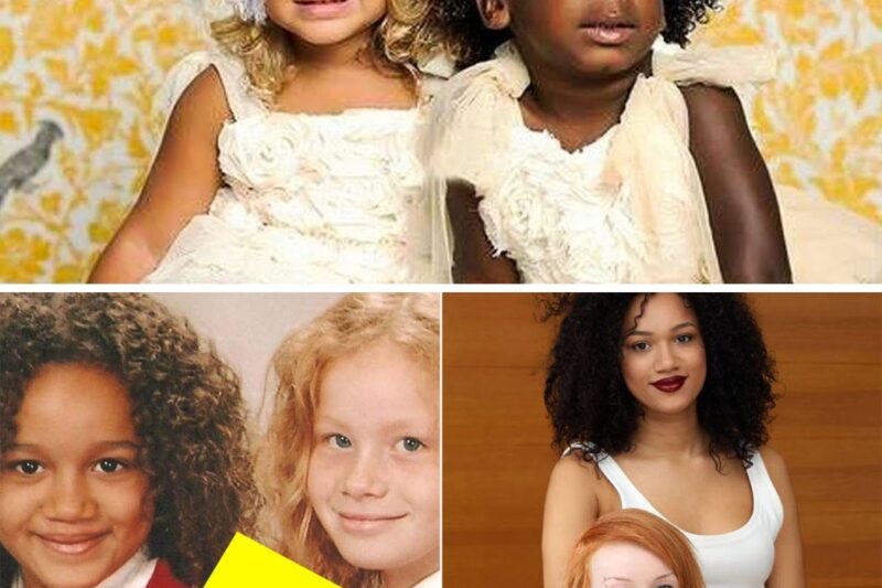 Mom’s Twins Are Different 18 Years Later, They’re Unrecognizable