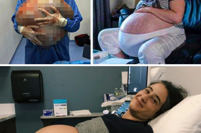 Woman looks like she’s pregnant with 10 children Then she sees scans and can’t believe her eyes 1
