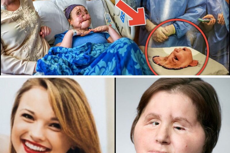 This Woman Had America’s First Face Transplant. Then Nine Years On She Shared Her Inspiring Story